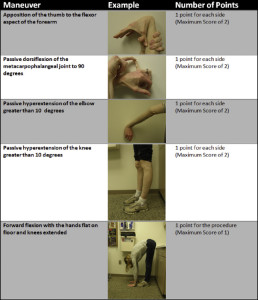 Joint Hypermobility Syndrome: Recognizing a Commonly Overlooked Cause ...